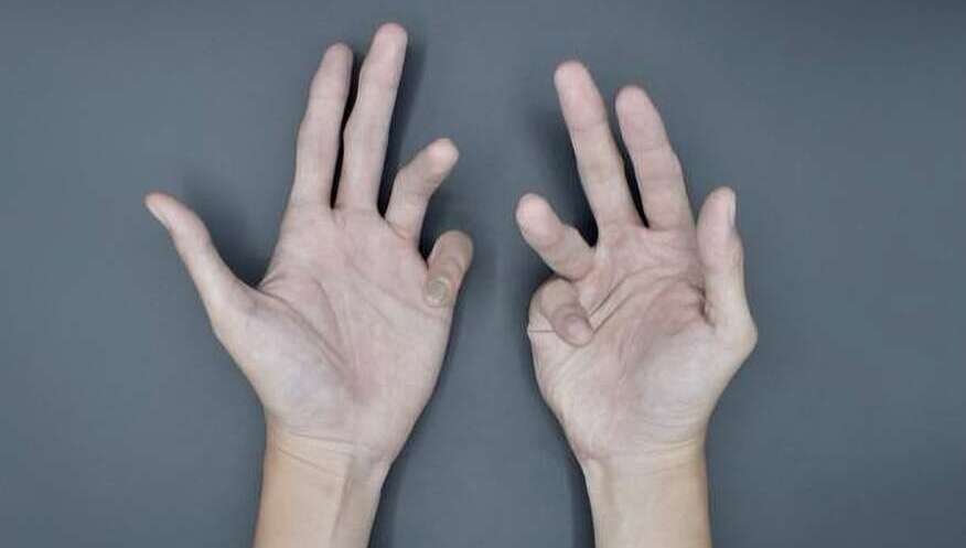 Congenital conditions