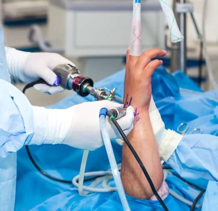 Hand reconstructive surgery